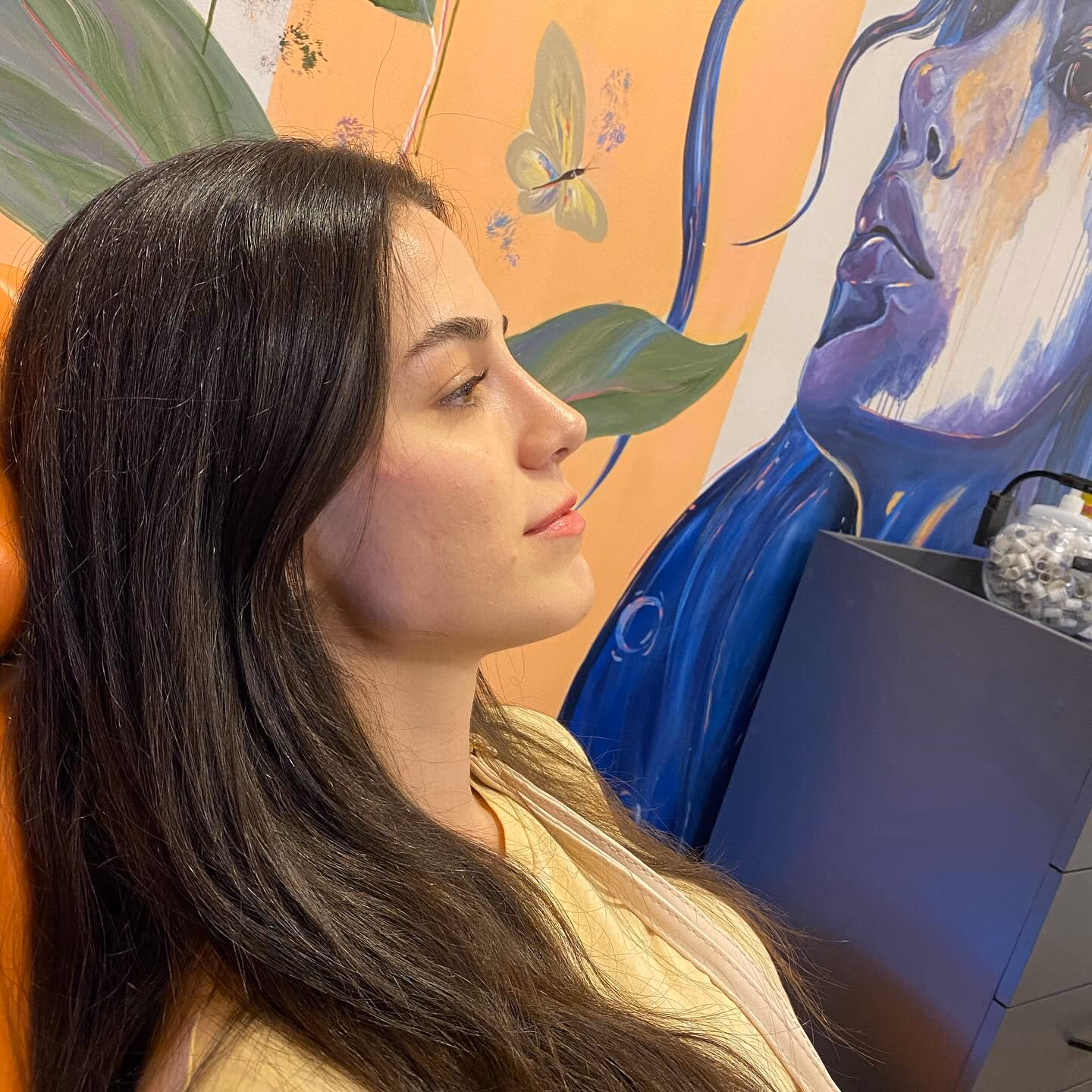 Patient with long dark hair after rhinoplasty in Ankara, side profile