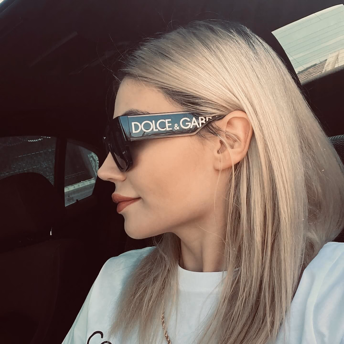 Blonde patient wearing sunglasses after rhinoplasty in Ankara, side profile